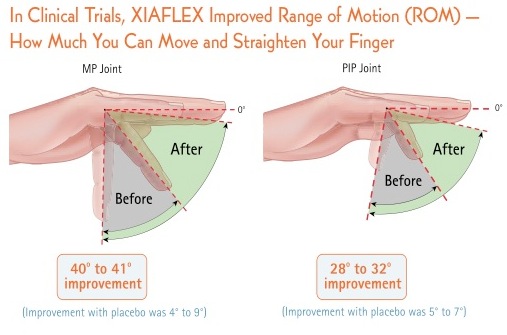 Xiapex